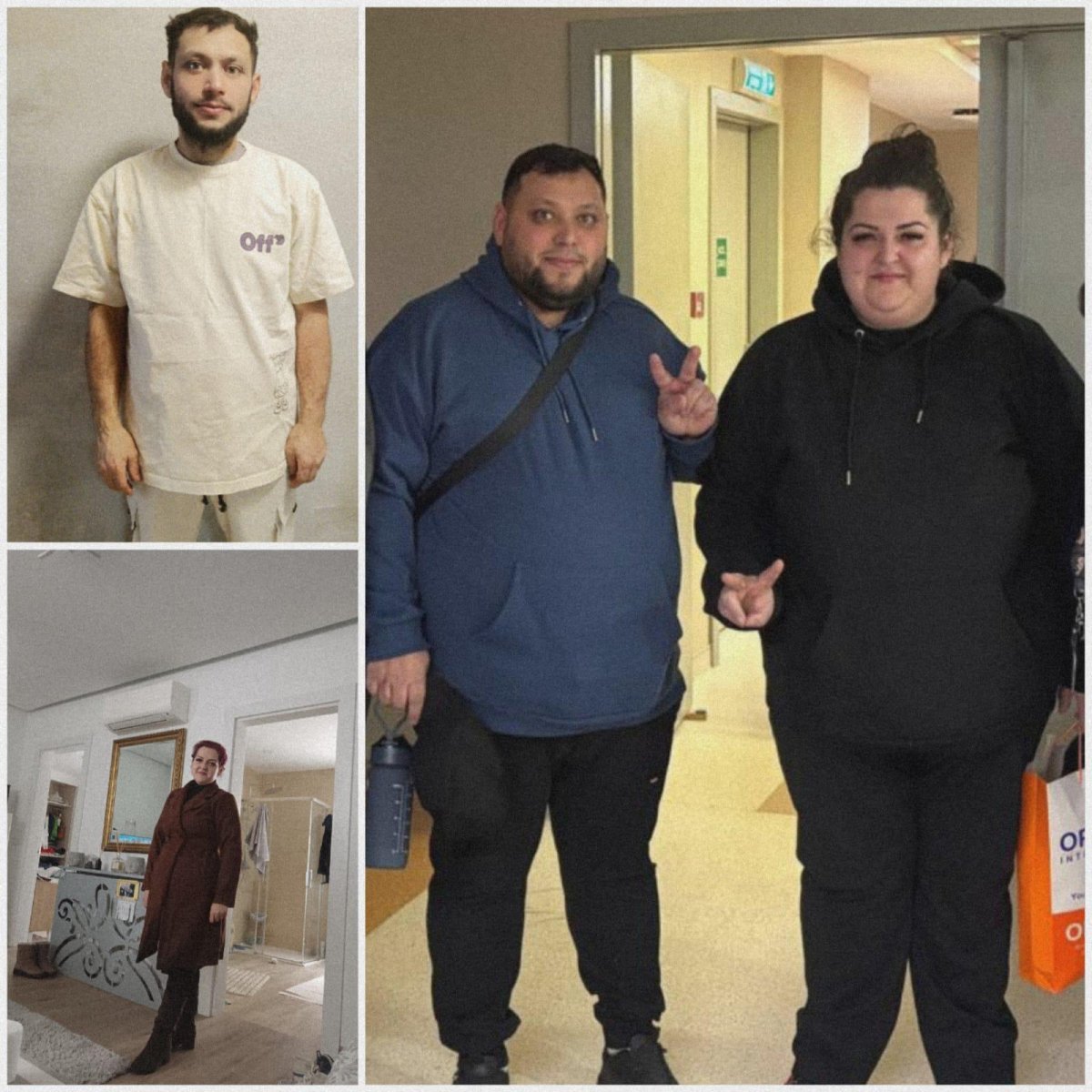 Resultados antes y después de manga gástrica en Optimed International Hospital, pérdida de peso