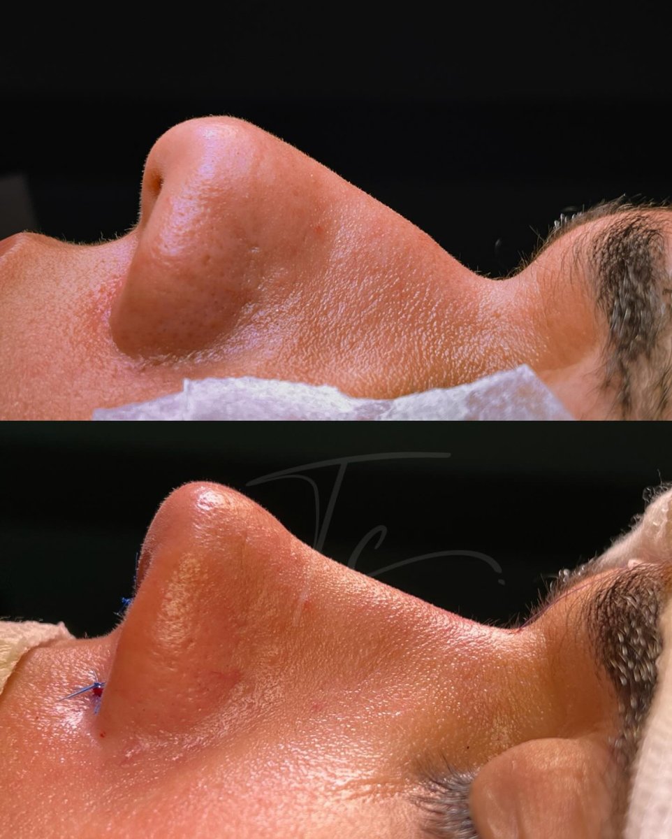 before and after photo
