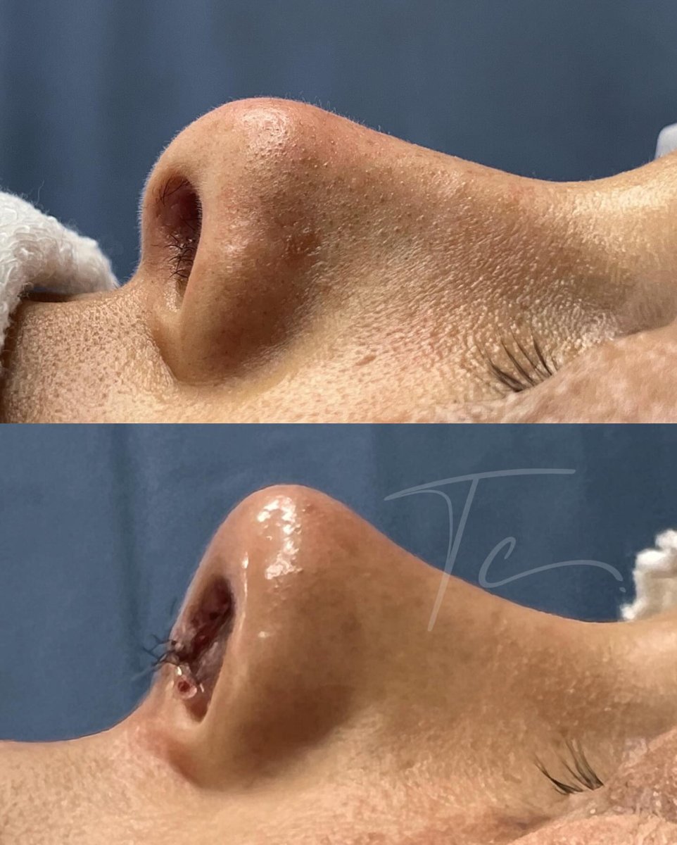 before and after photo