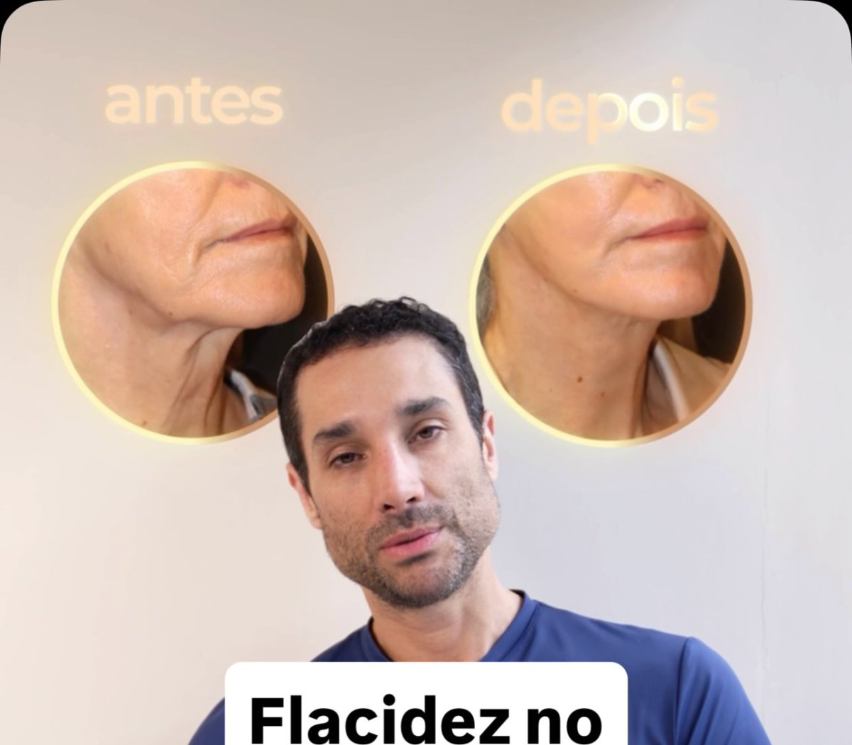 before and after photo