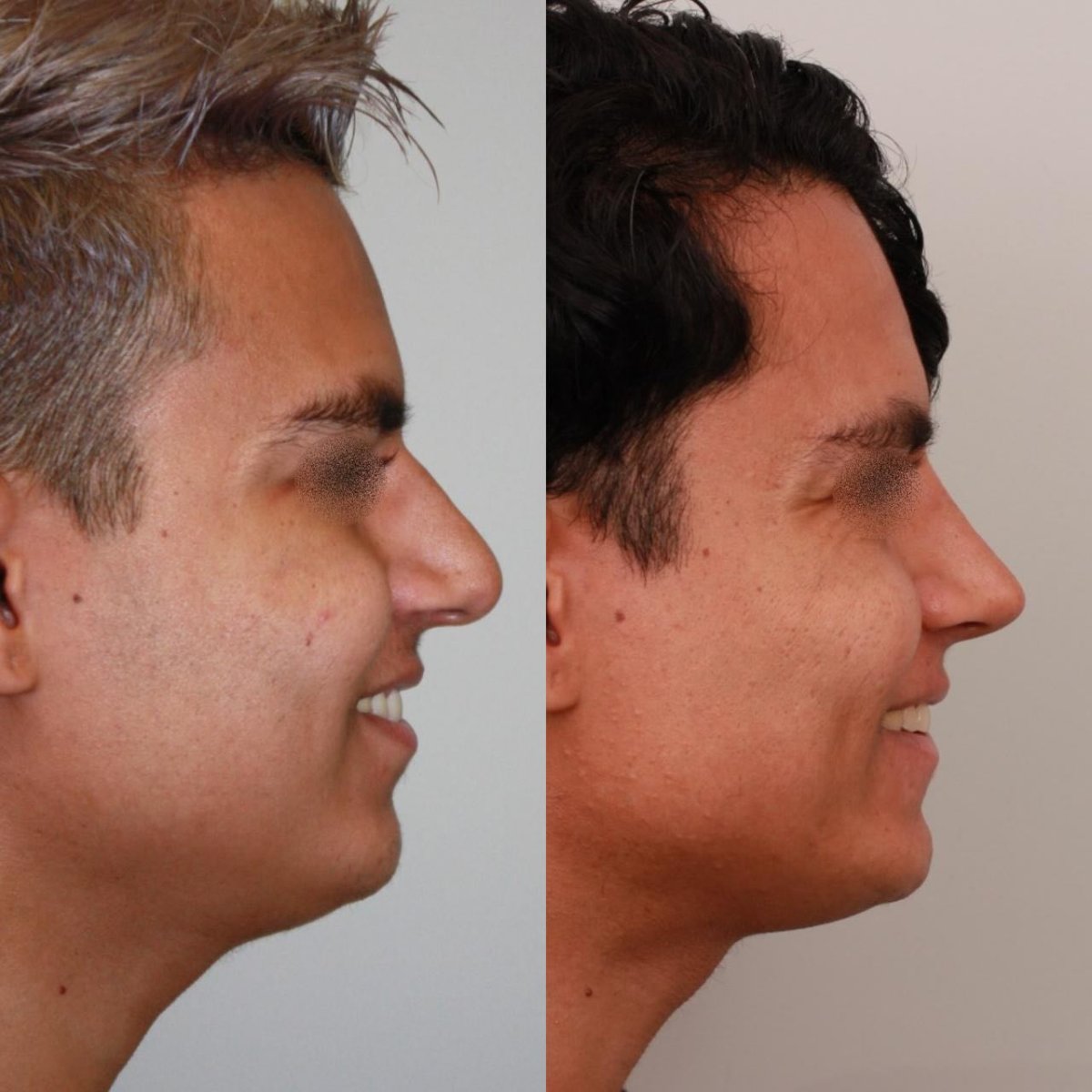 before and after photo
