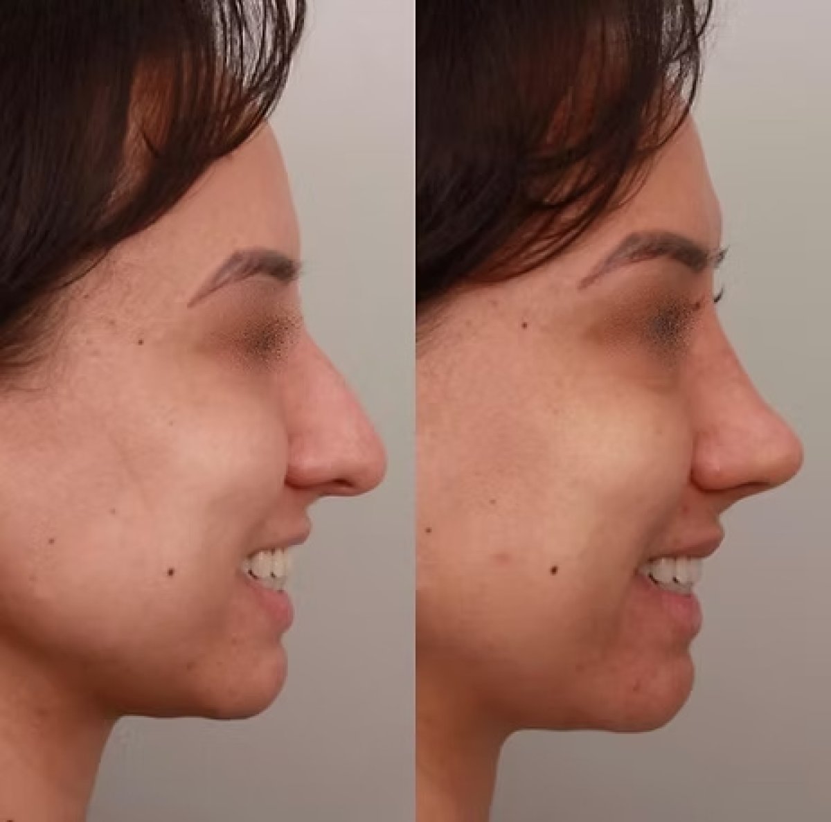 before and after photo