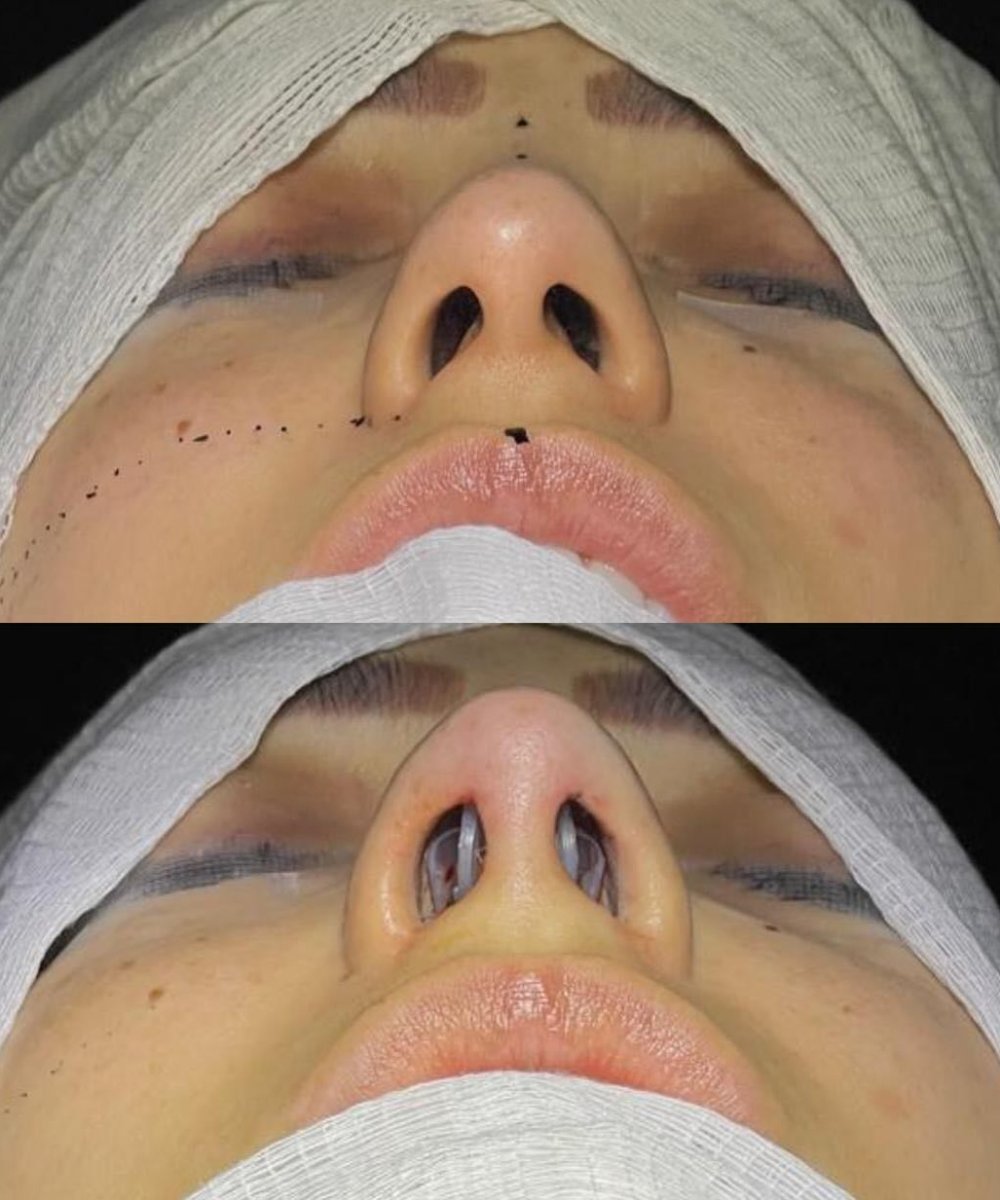 before and after photo
