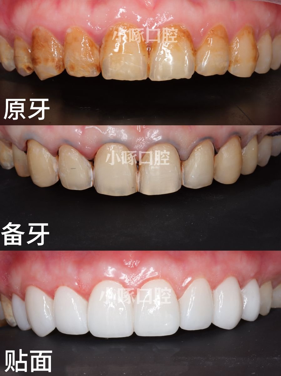 before and after photo