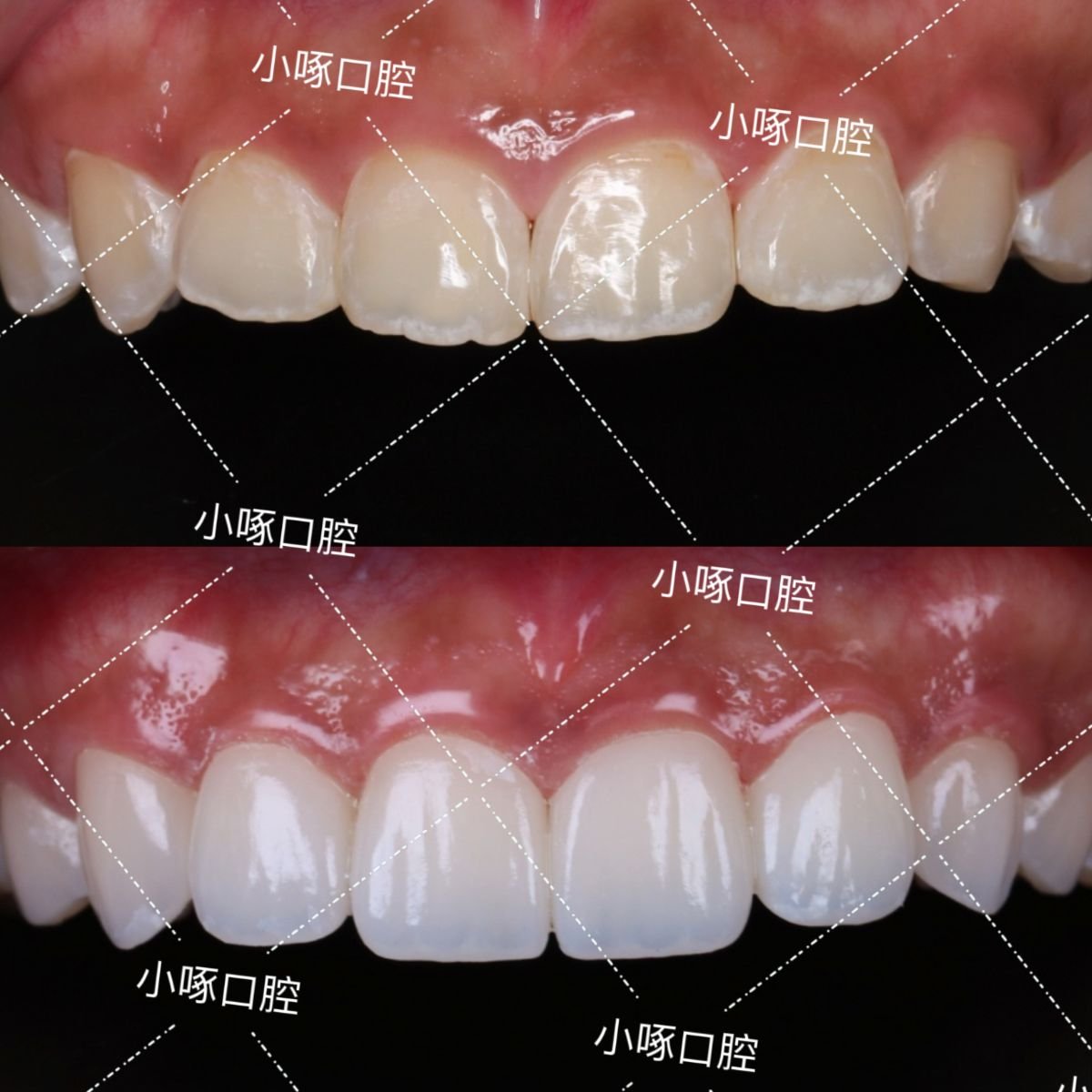 before and after photo