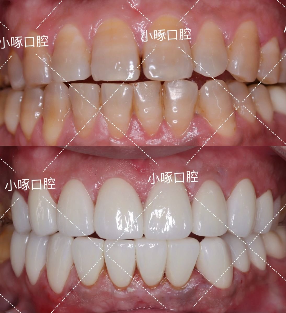 before and after photo