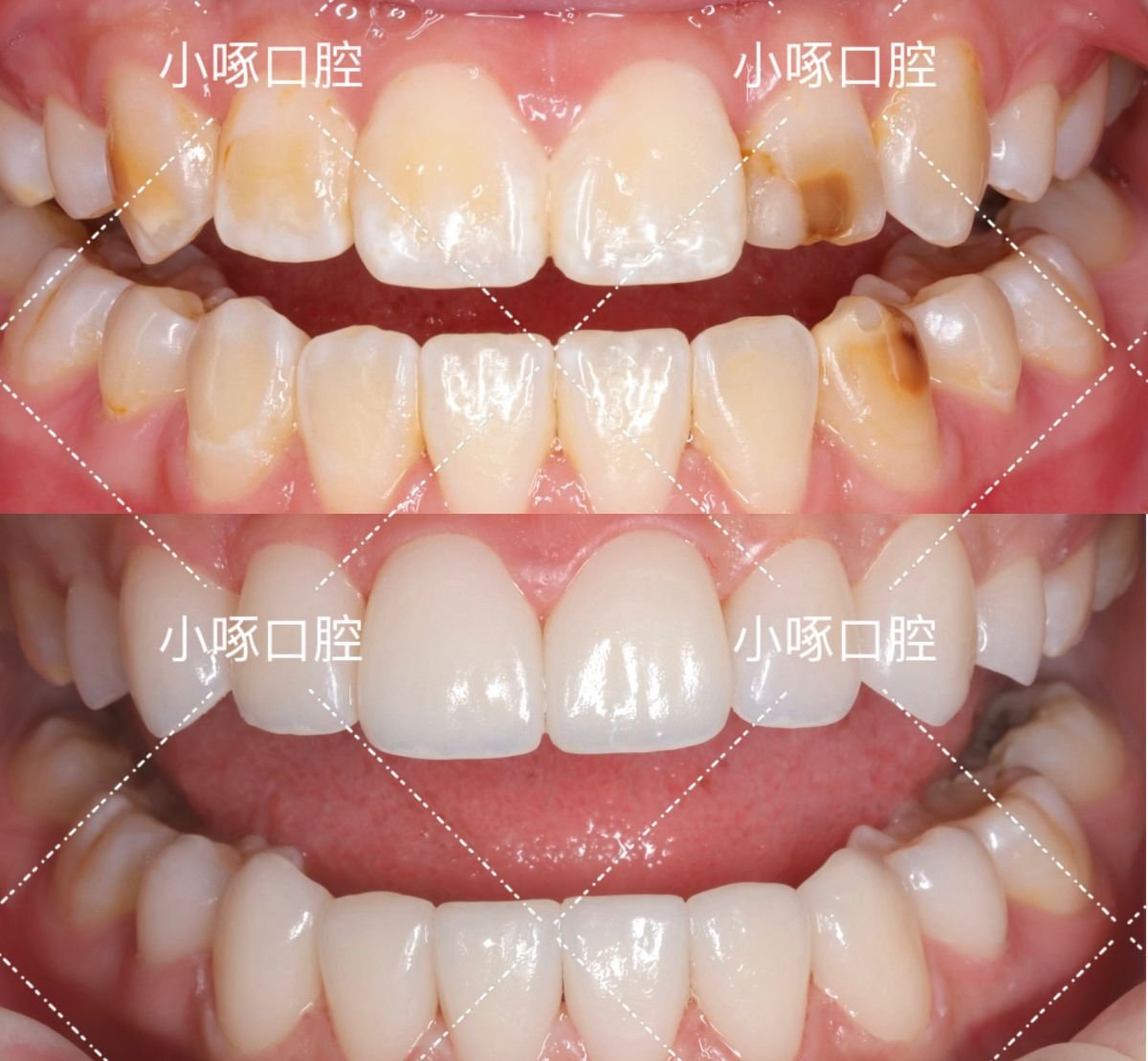 before and after photo