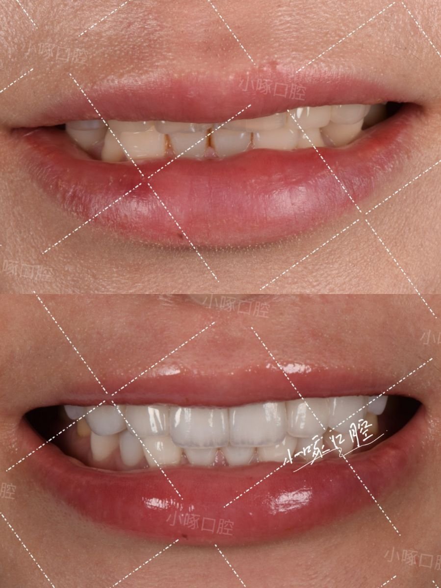 before and after photo