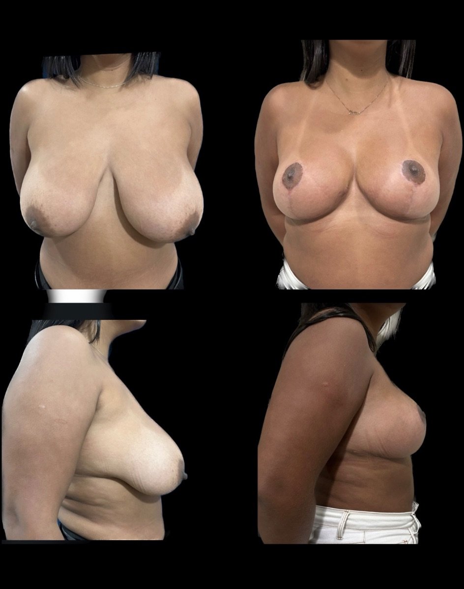before and after photo