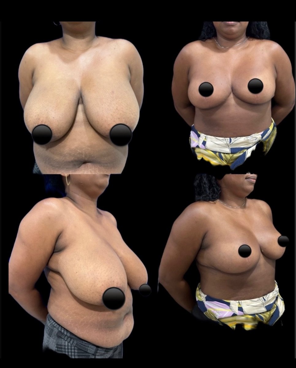 before and after photo