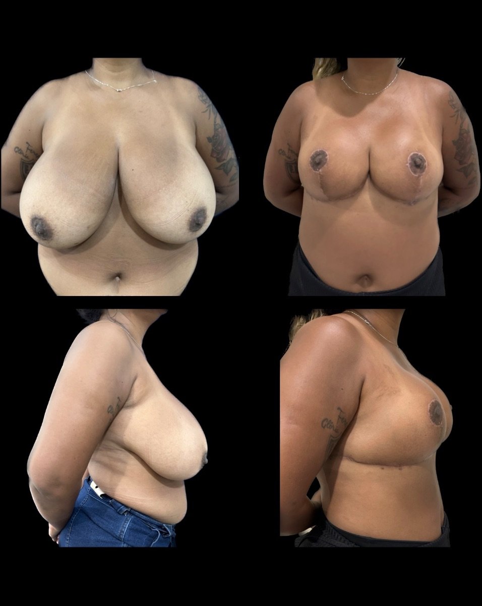 before and after photo