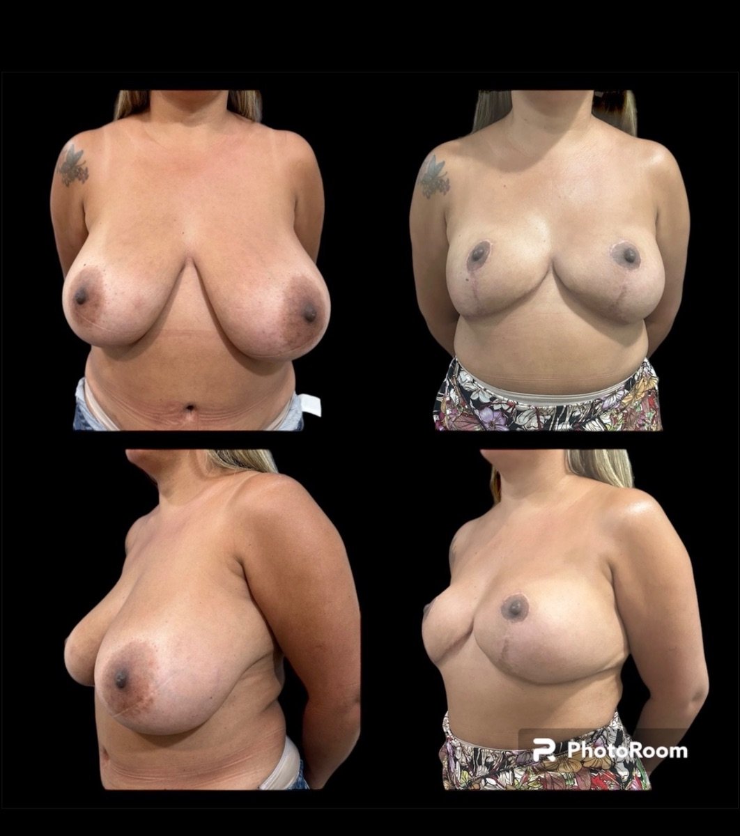 before and after photo