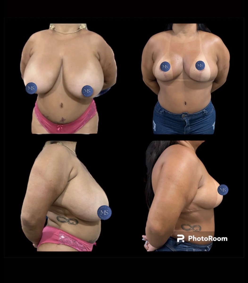 before and after photo