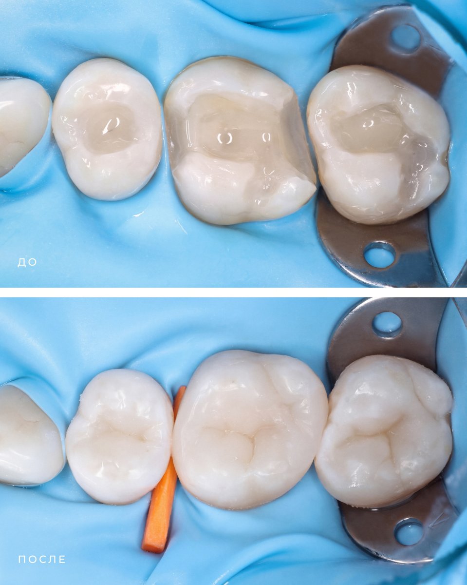 before and after photo