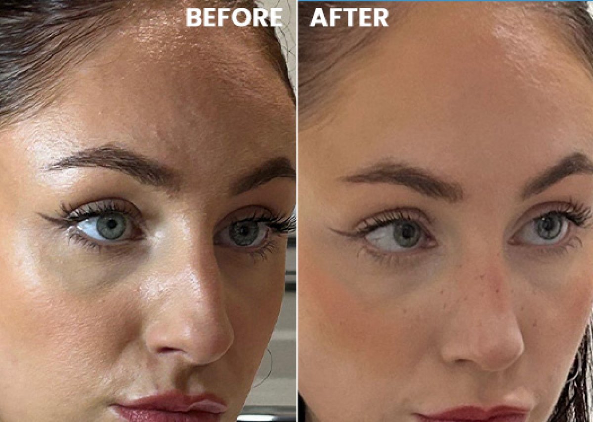 before and after photo