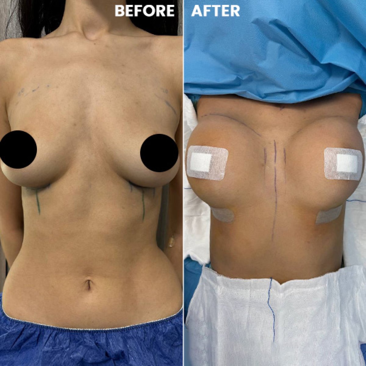 before and after photo
