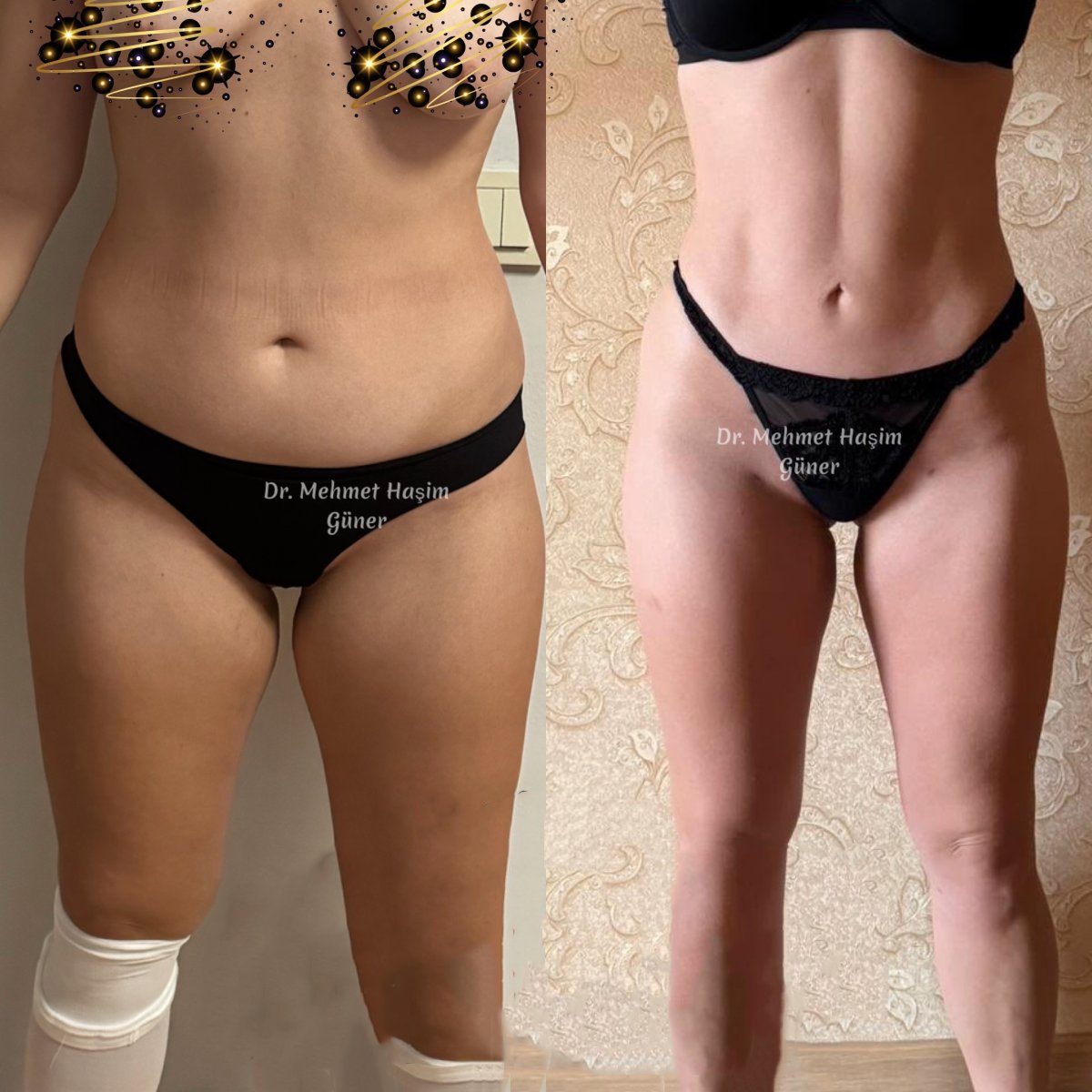 before and after photo