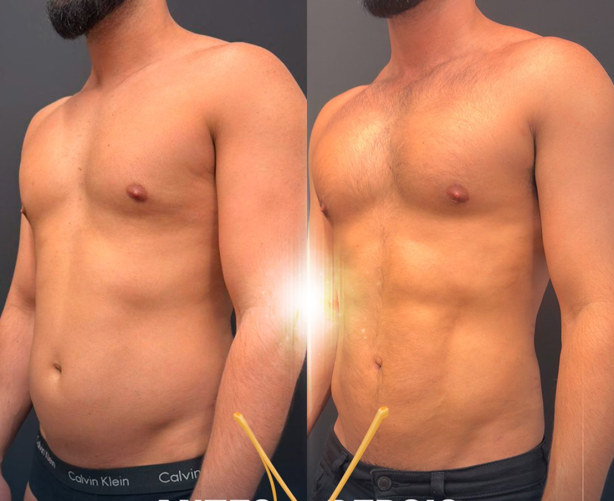 before and after photo