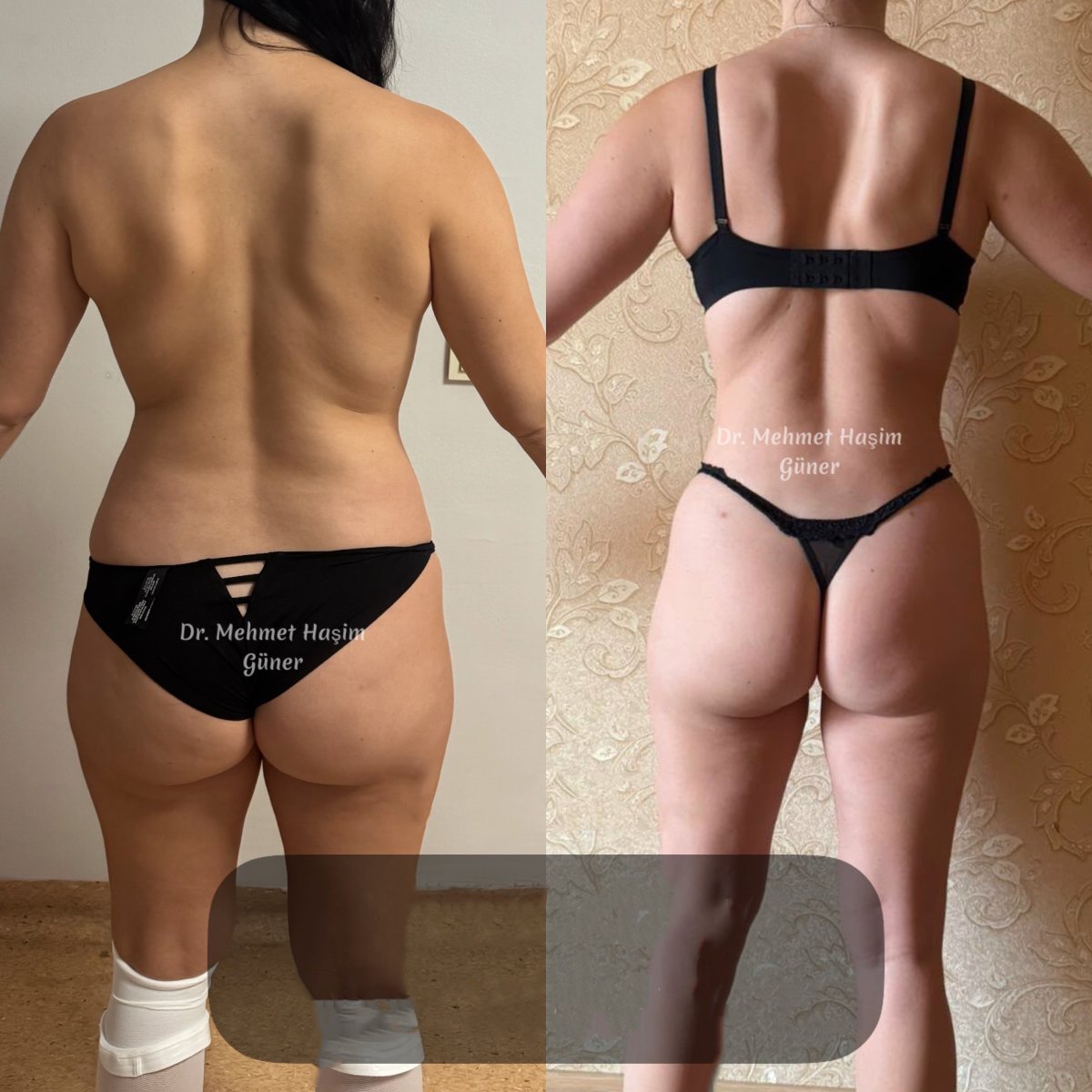 before and after photo