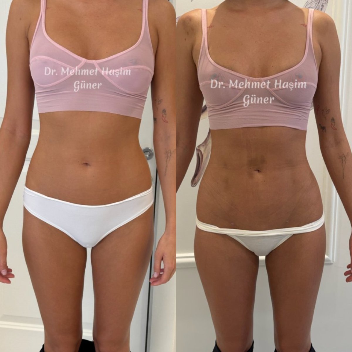 before and after photo