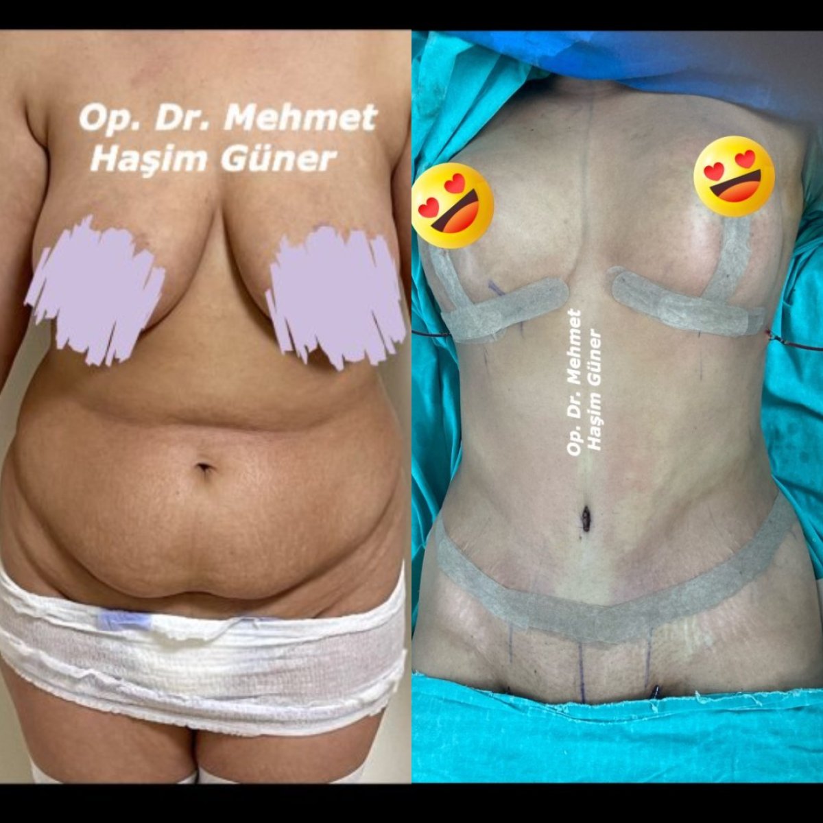 before and after photo