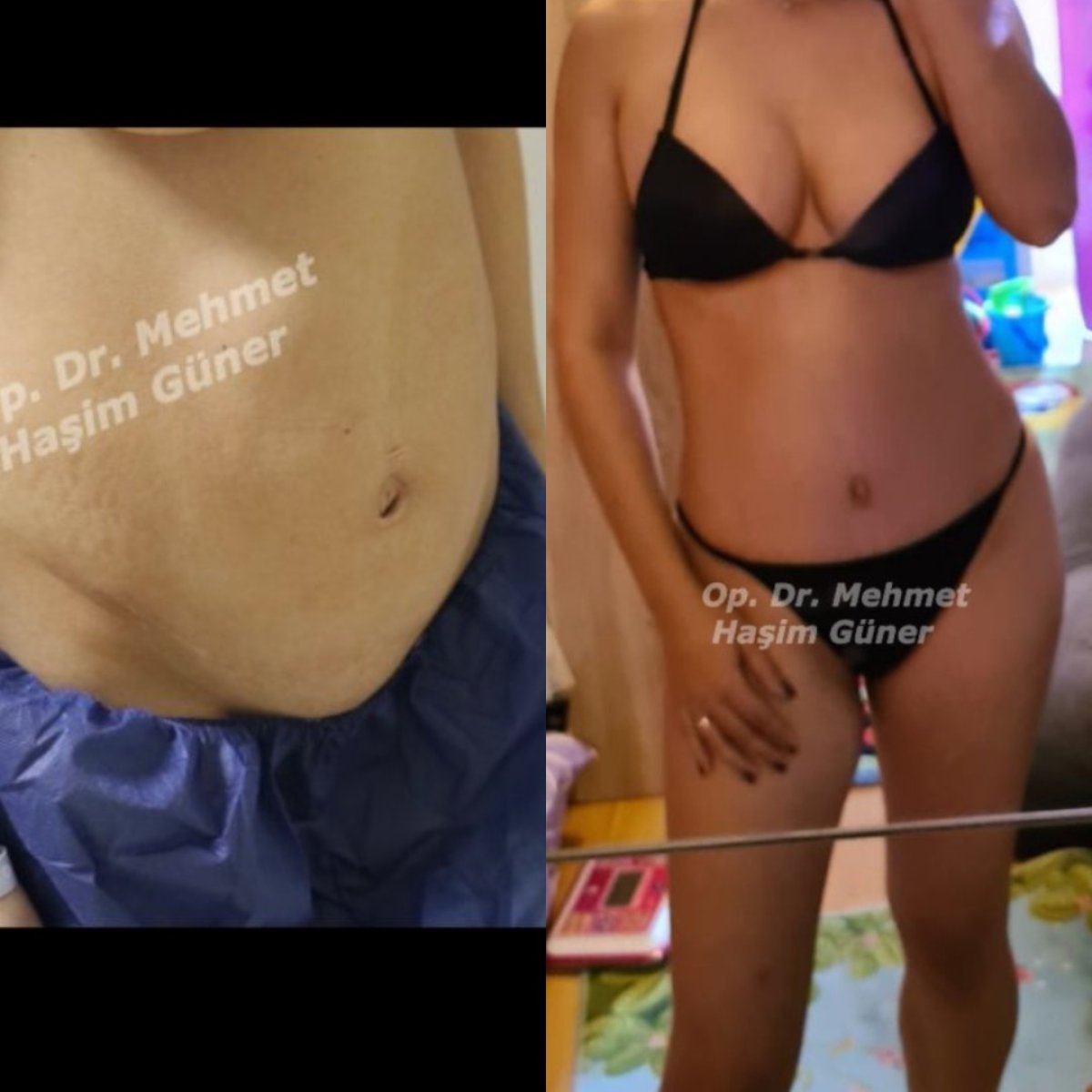 before and after photo