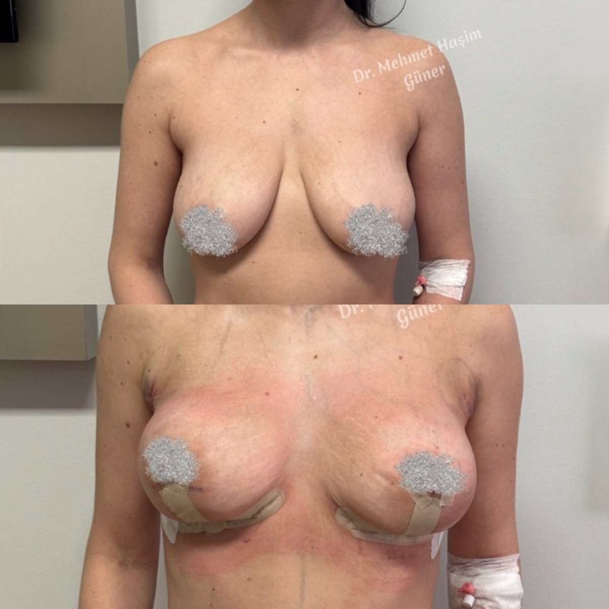 before and after photo
