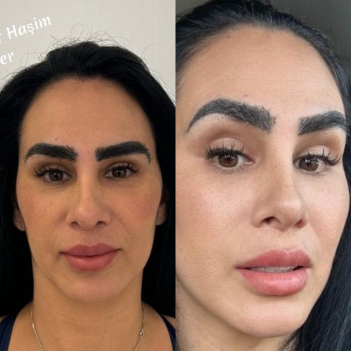 before and after photo