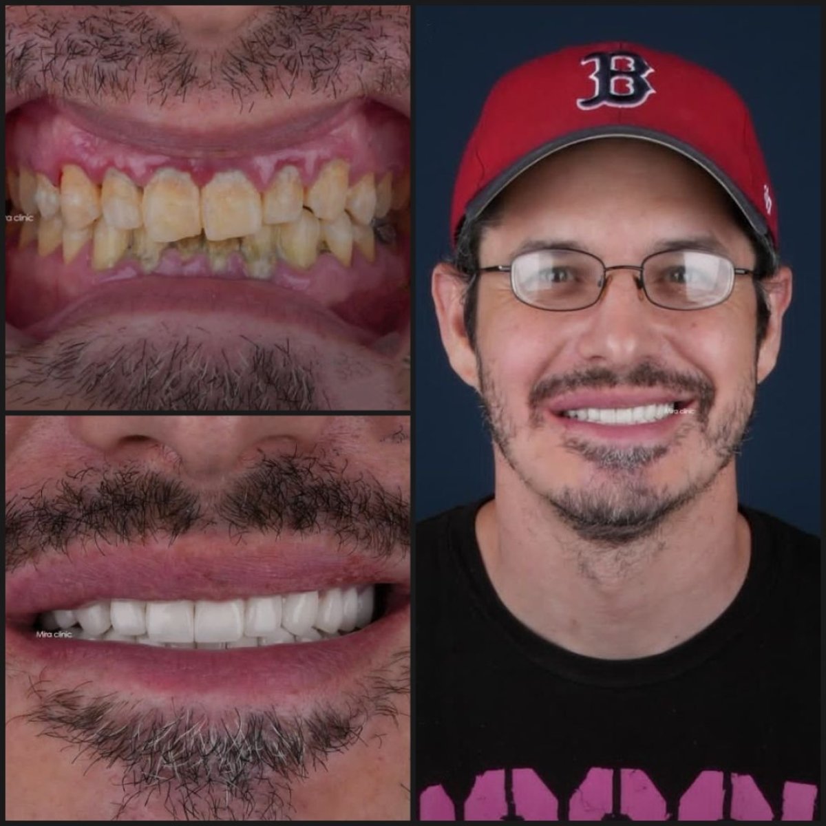 before and after photo