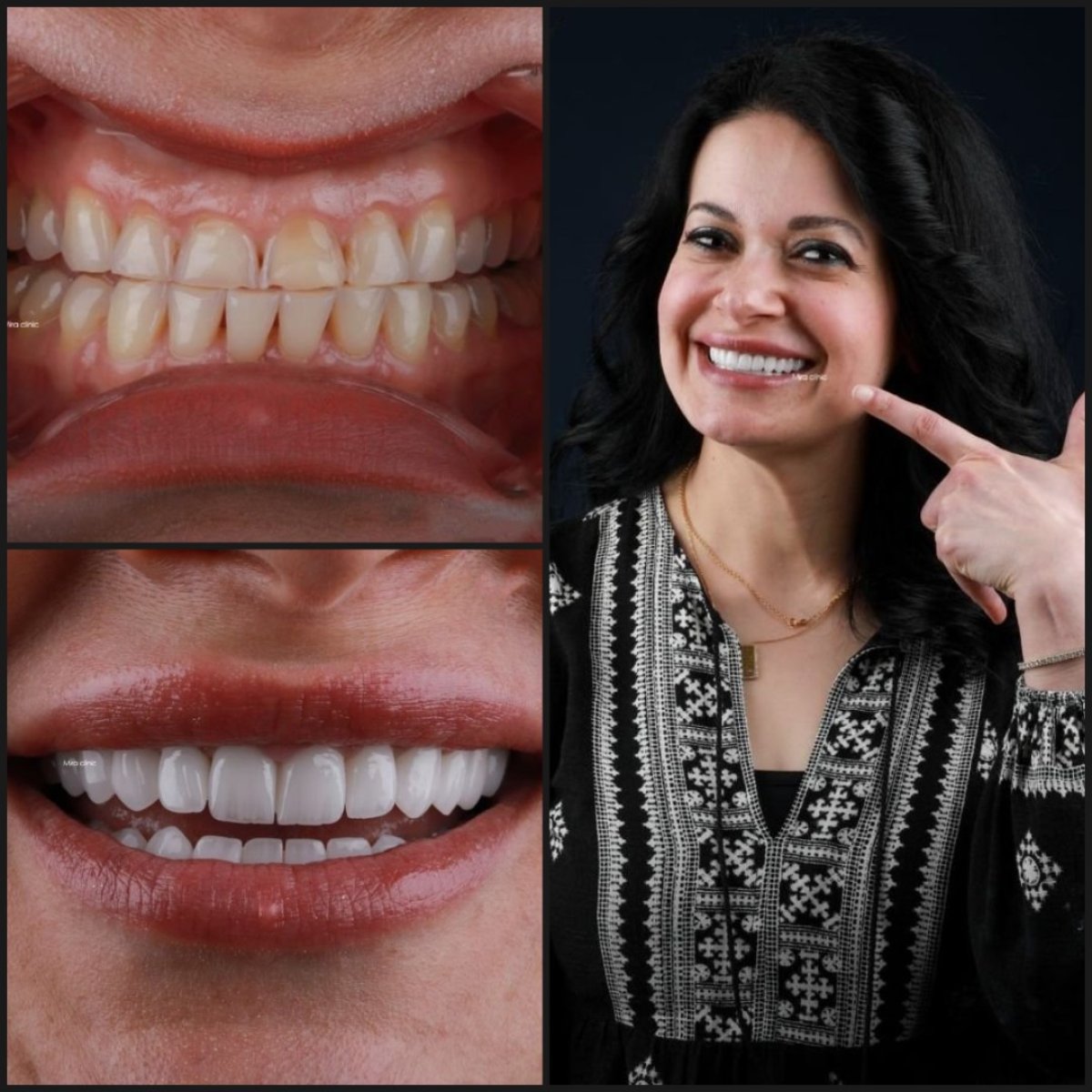 before and after photo