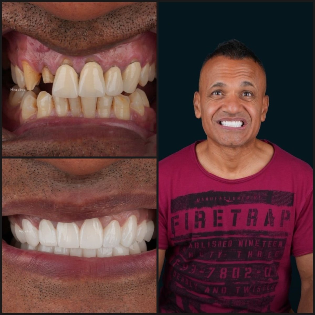 before and after photo