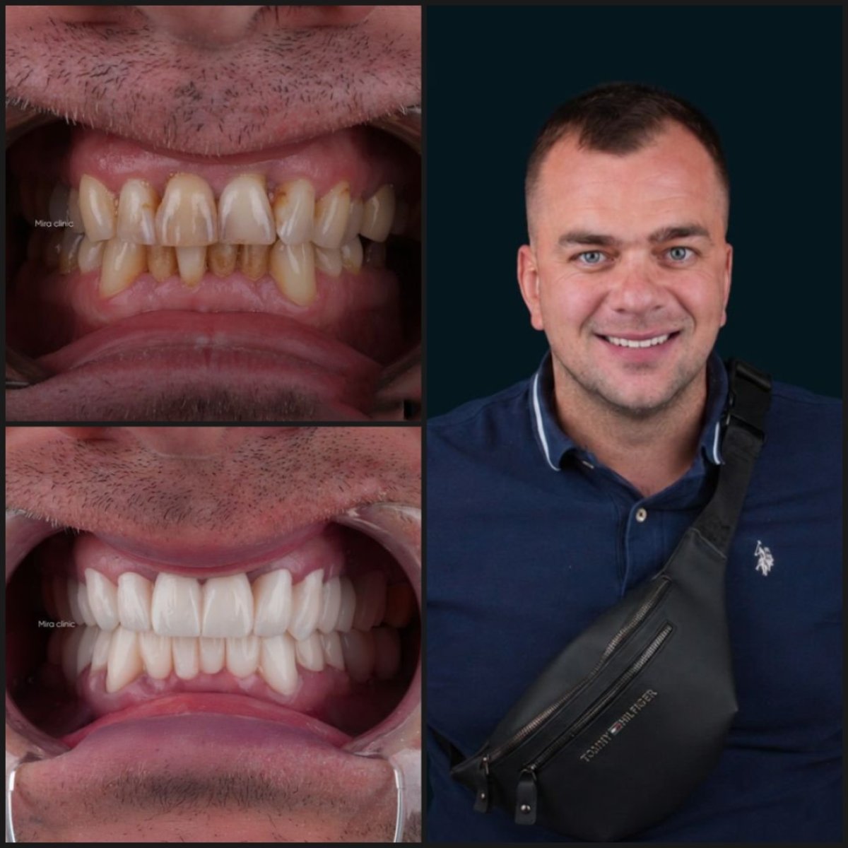 before and after photo