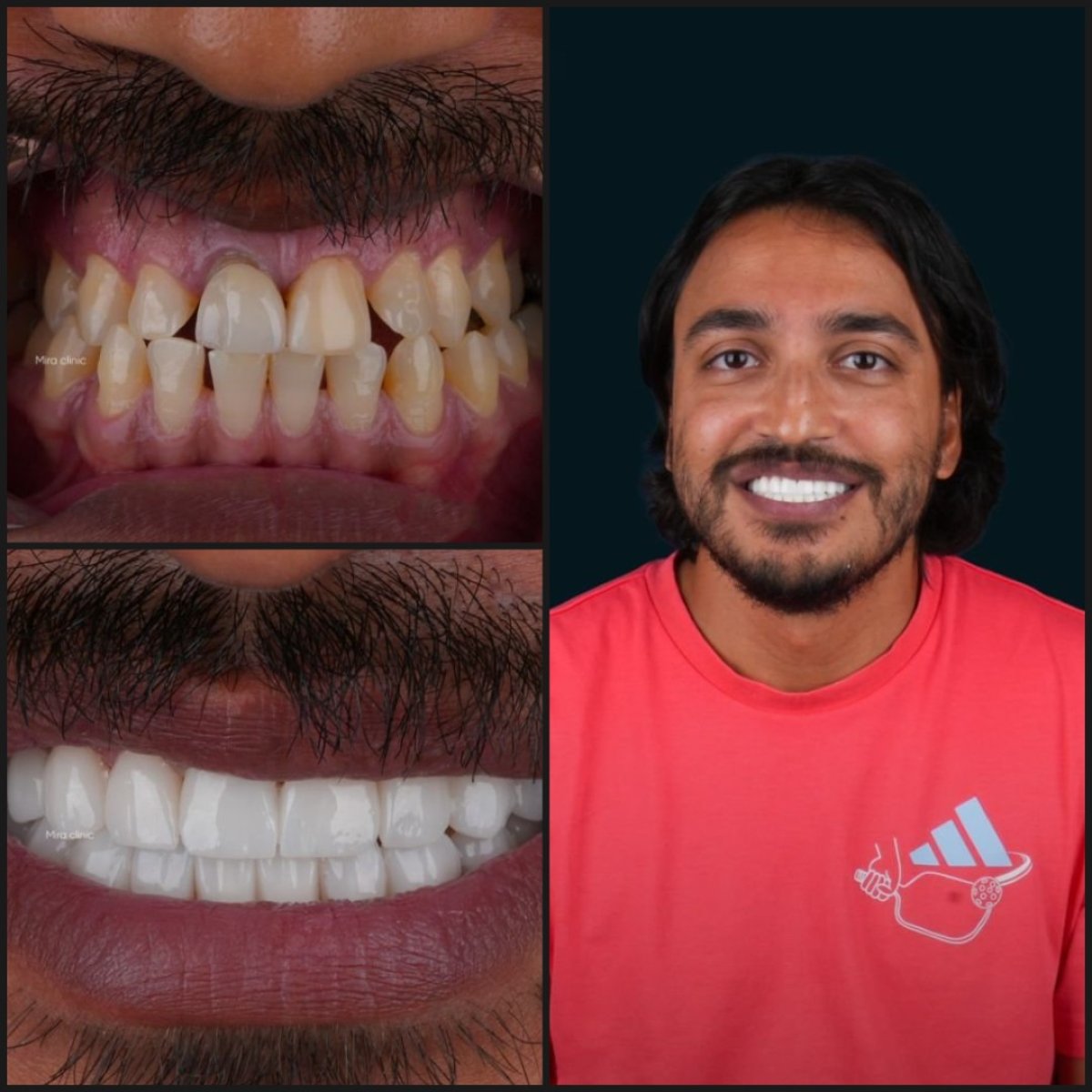 before and after photo