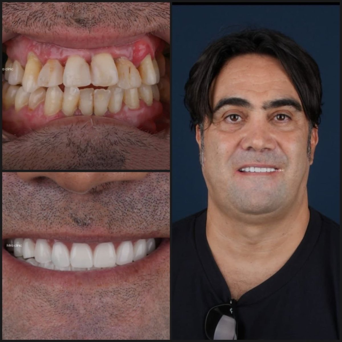 before and after photo