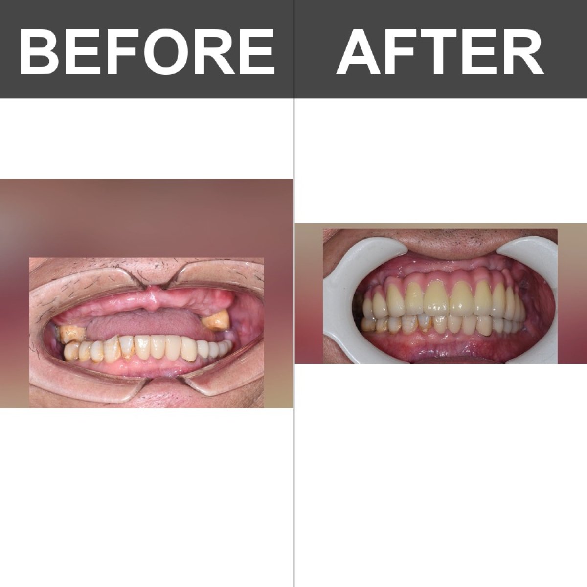 before and after photo