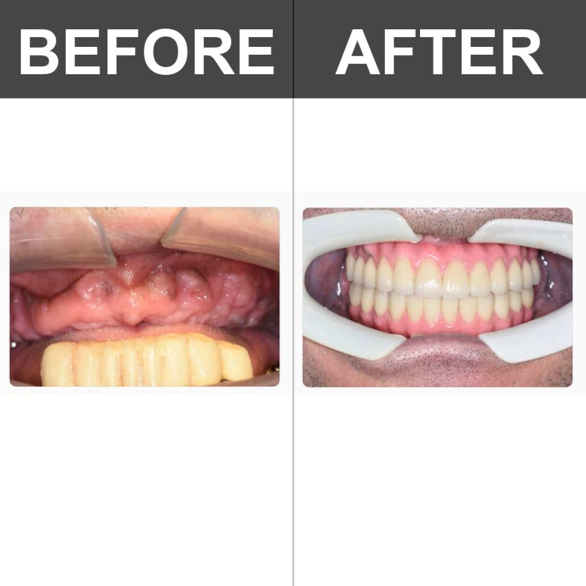 before and after photo