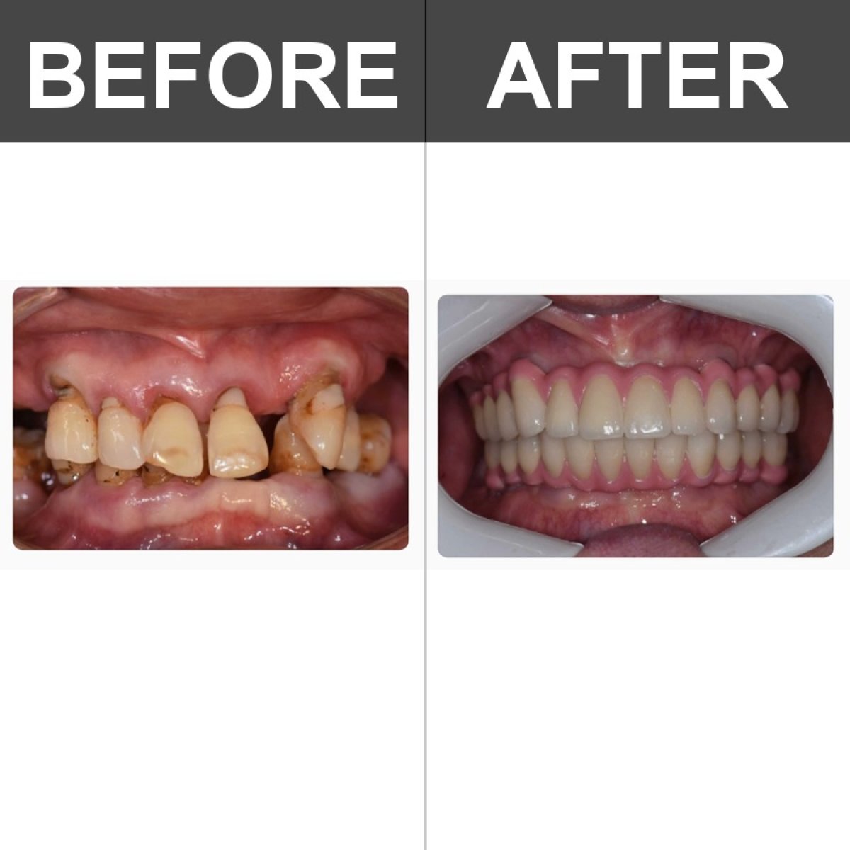 before and after photo