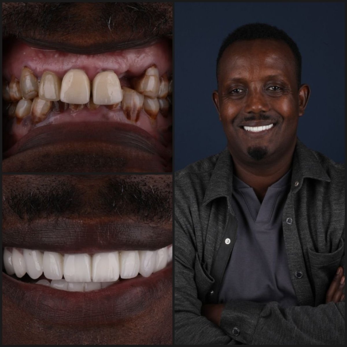 before and after photo