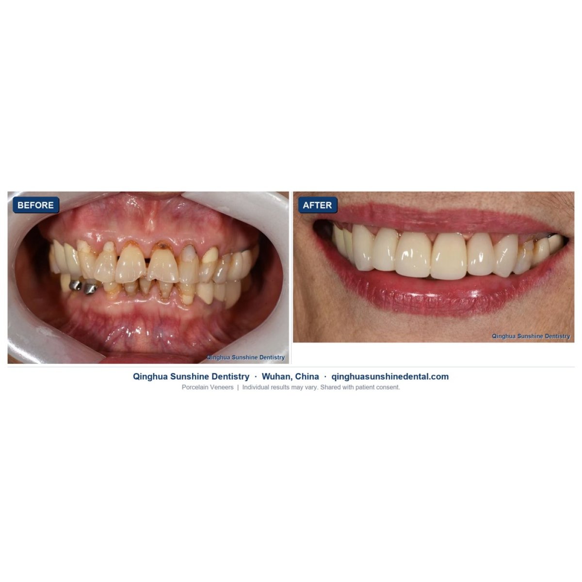 before and after photo