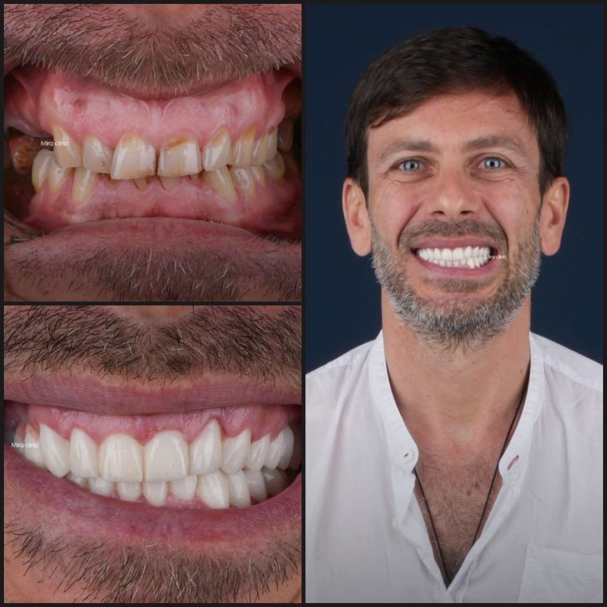 before and after photo