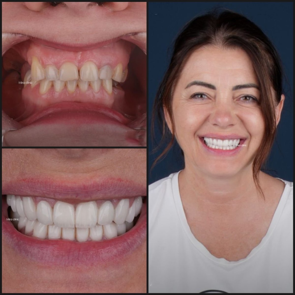 before and after photo