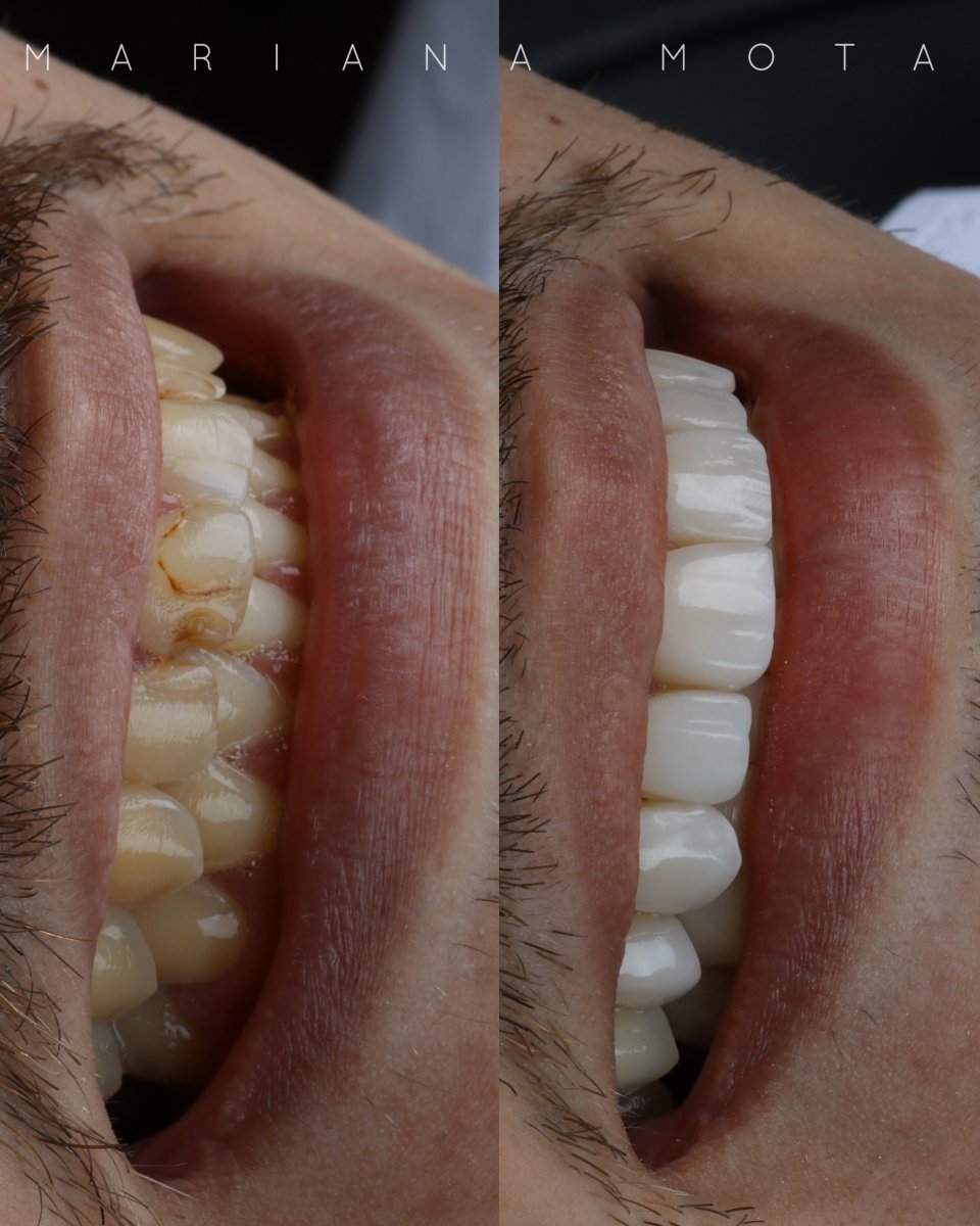 before and after photo