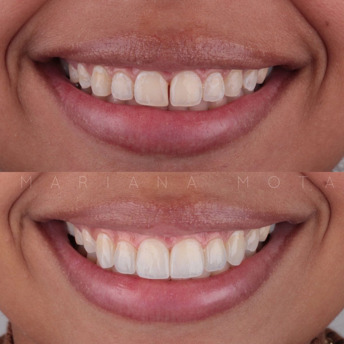 before and after photo