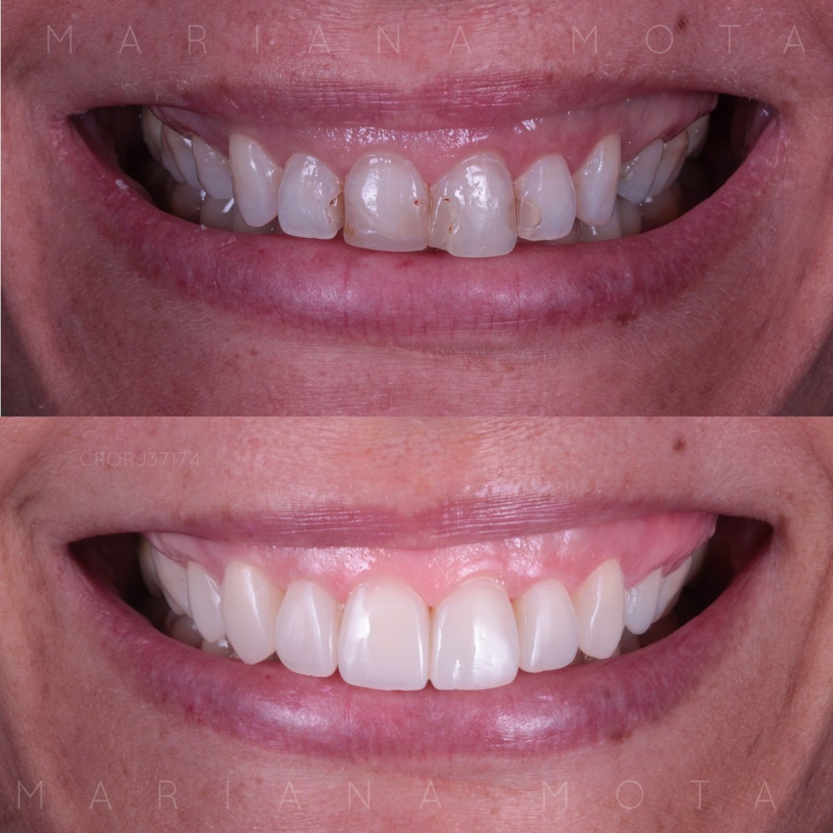 before and after photo