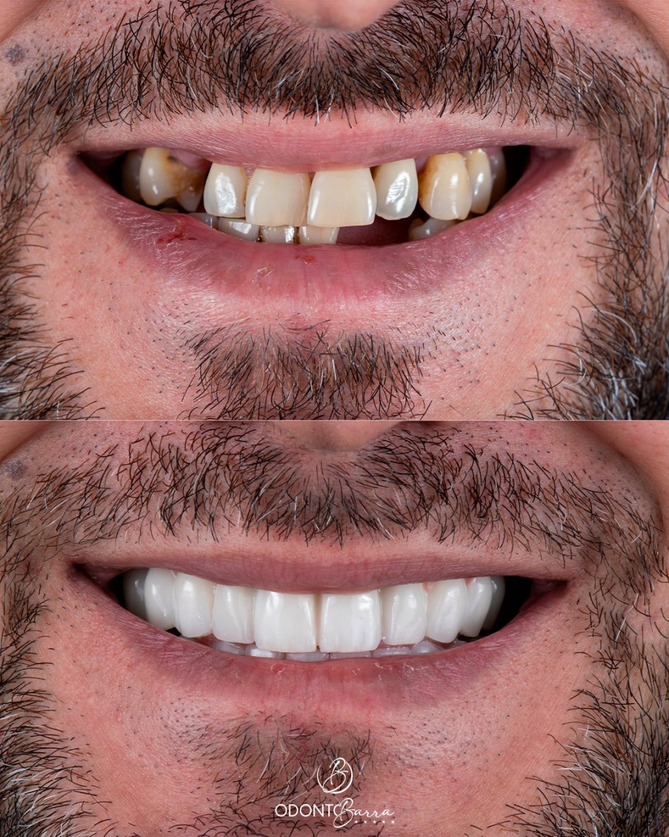 before and after photo