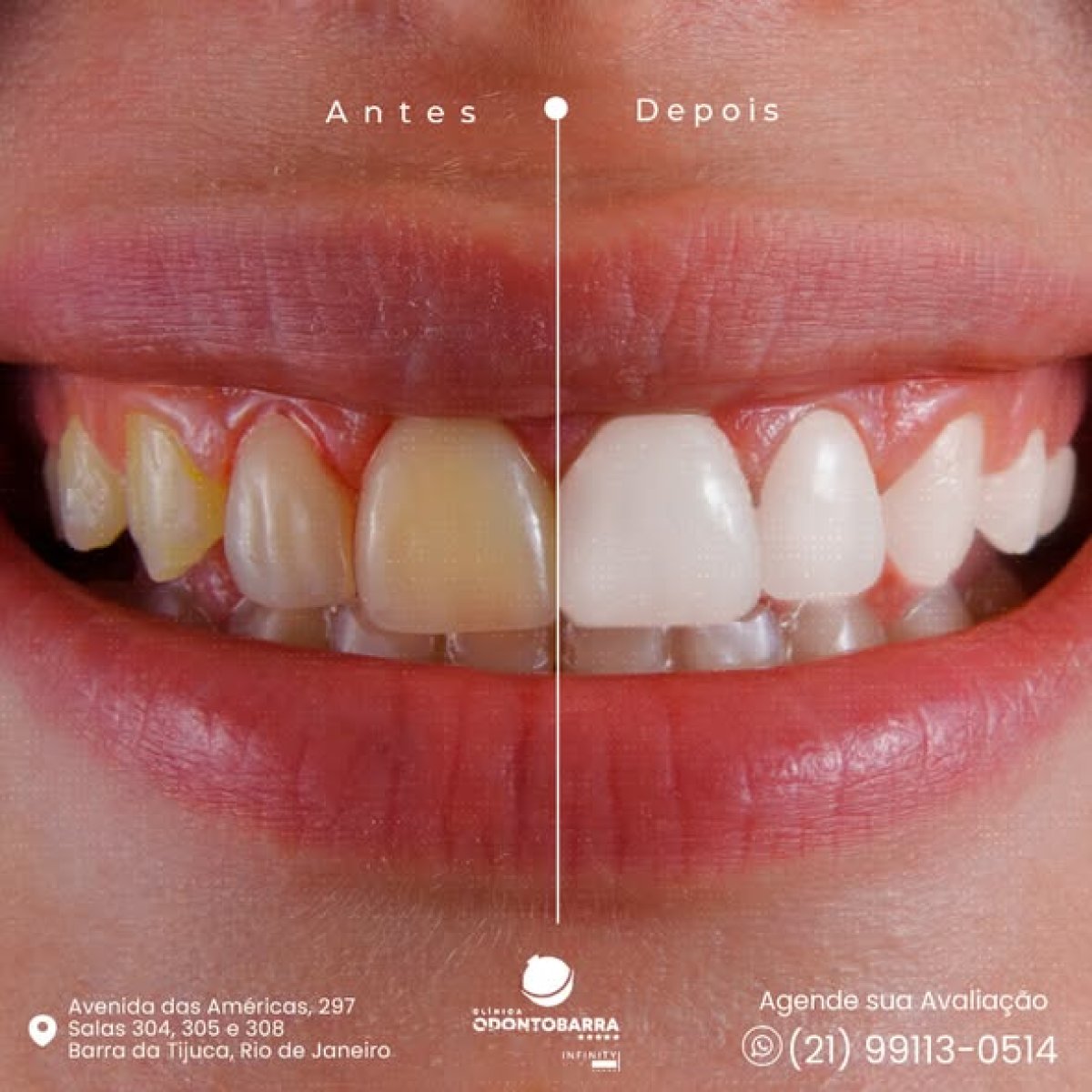 before and after photo