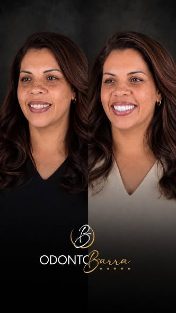 before and after photo