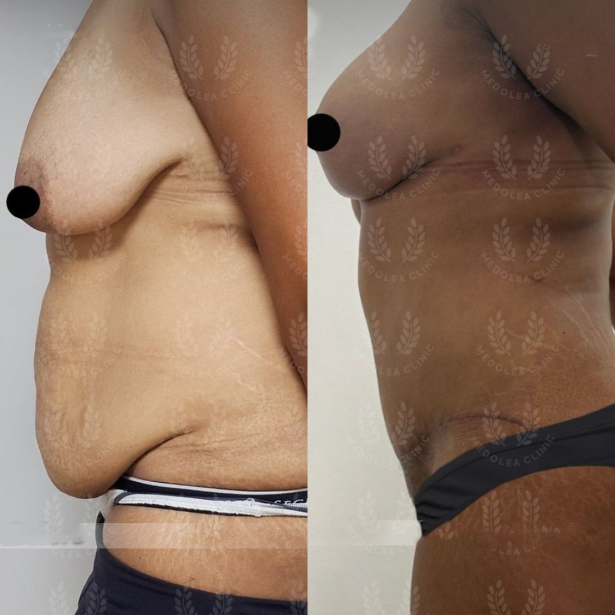before and after photo