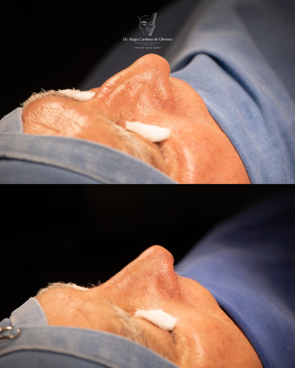 before and after photo