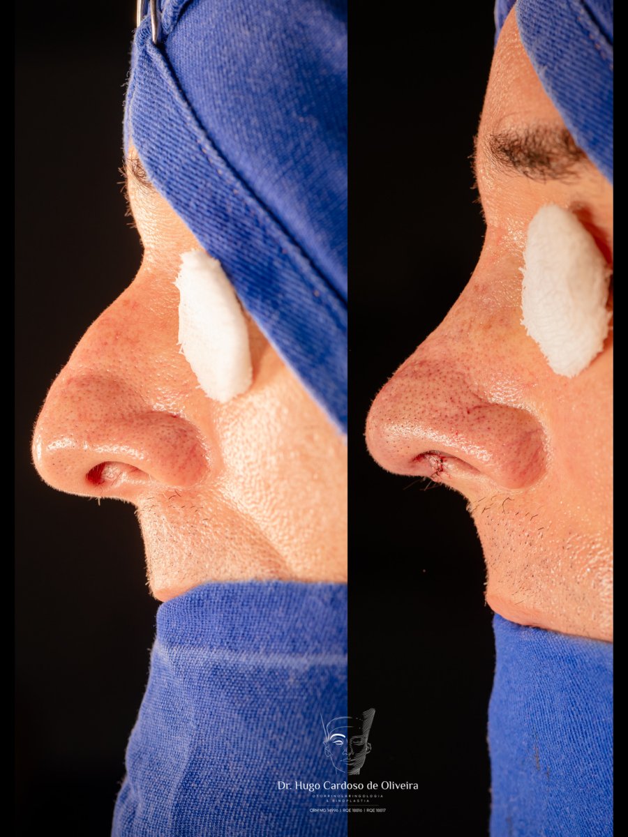 before and after photo